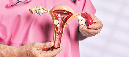 IUI