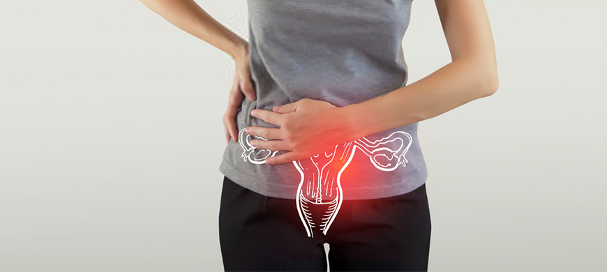 IUI