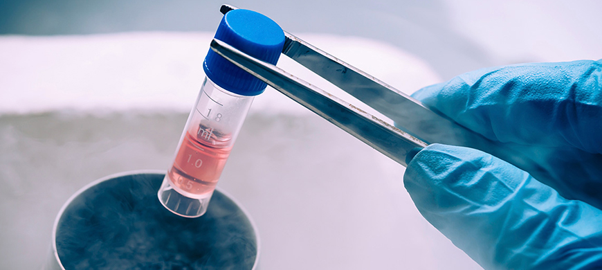 cryopreservation